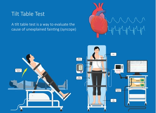 When Is A Tilt Table Test Necessary? - Central Georgia Heart Center