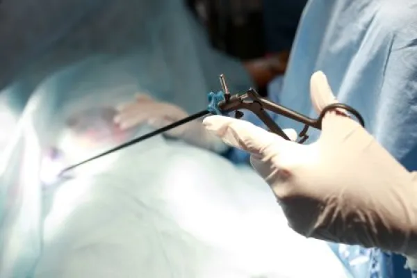 surgeons performing laparoscopic surgery on patient in operating room