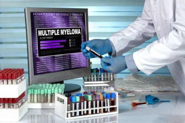 doctor in lab examining blood sample with the text multiple myeloma in screen of computer / technician with blood sample and text multiple myeloma in the software of analysis laboratory