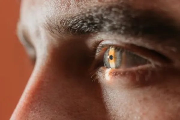 Close-up of a human eye showcasing intricate details, highlighting the cornea and iris during an ophthalmology examination