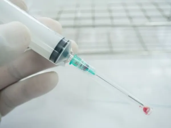 Close up doctor hand holding syringe during smear fine needle aspiration (FNA) from specimen breast.