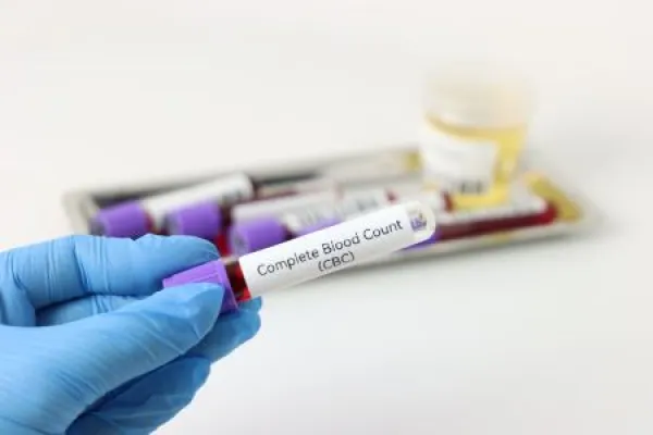 lood test sample for complete blood count test beeing hold by a professional wearing gloves and other blood and urine samples in the background.