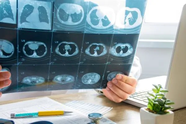 Doctor at appointment inspects and examines ct scan of chest and abdominal cavity.