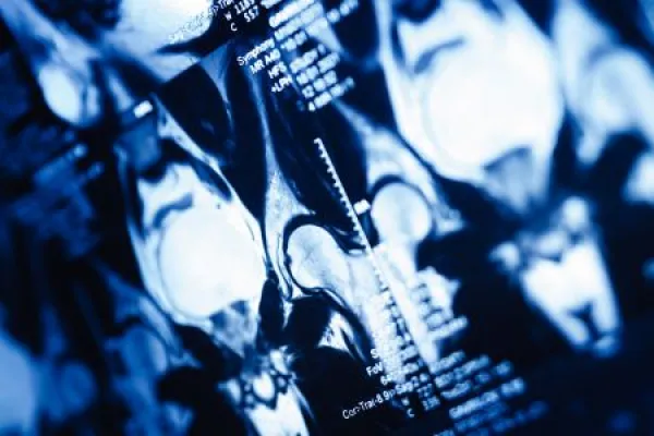 MRI scans show detailed views of knee joints