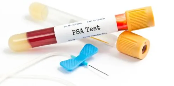 PSA Test 