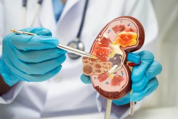 Chronic kidney disease, doctor with model for treatment urinary system, urology, Estimated glomerular filtration